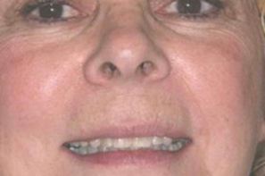 Woman with discolored teeth