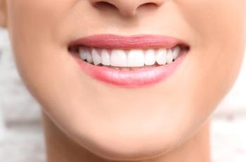 Closeup of white smile after dental bonding