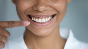 smiling woman pointing to her mouth