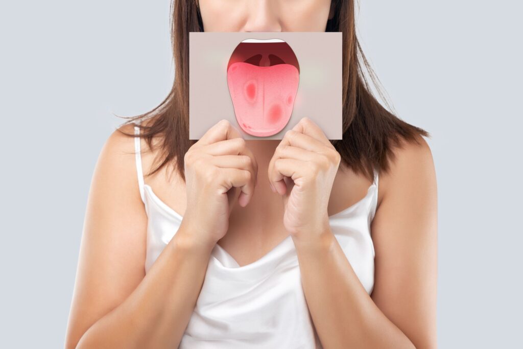 Woman holding up a picture of a tongue with sores on it to cover her mouth